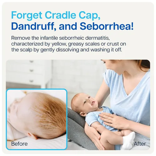 Miniatura 8 de NAVEH PHARMA Limpiador de tapa de cuna para bebés y niños Tratamiento de tapa de cuna 100% natural Spray y lavado sin fregar Mejor que