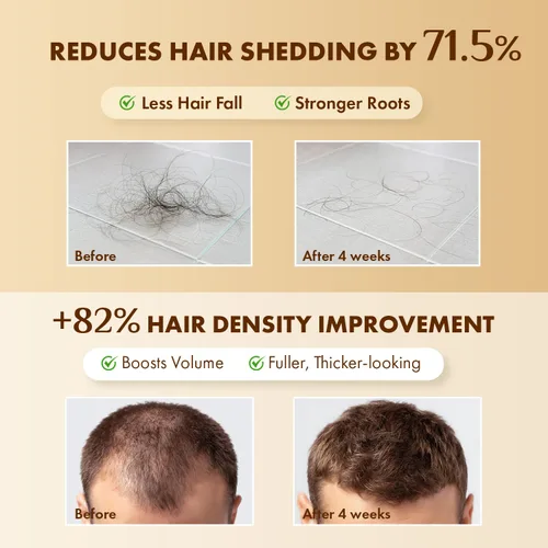 Miniatura 3 de Tratamiento del cuero cabelludo con suero para el crecimiento del cabello: suero para el cuero cabelludo con romero, multipéptido y cafeína