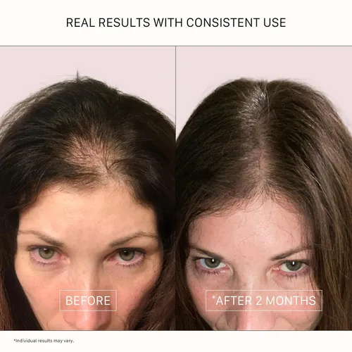 Miniatura 5 de ACTIIV Recover Tratamiento de Champú Densificante para Mujeres Apoya la apariencia de un cabello más abundante y saludable, apoya la salud