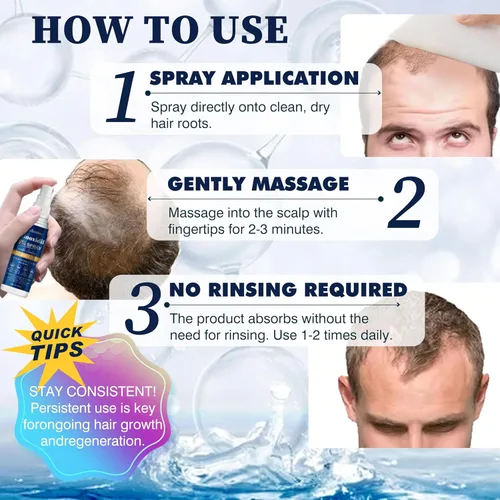 Miniatura 6 de Suero en aerosol para el crecimiento del cabello de minoxidil al 5 %, tratamiento para el crecimiento del cabello para hombres y mujeres, fortalece