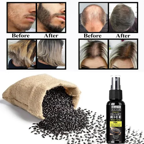 Miniatura 3 de Suero para el crecimiento del cabello para mujeres y hombres, spray de agua de arroz negro, tratamiento de pérdida de cabello para cabello dañado