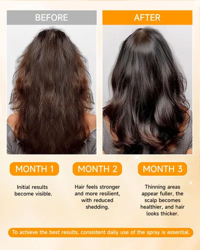 Miniatura 4 de Spray para el crecimiento del cabello, aceite en aerosol para el crecimiento del cabello, con Biota Orientalis, aceite de romero y biotina