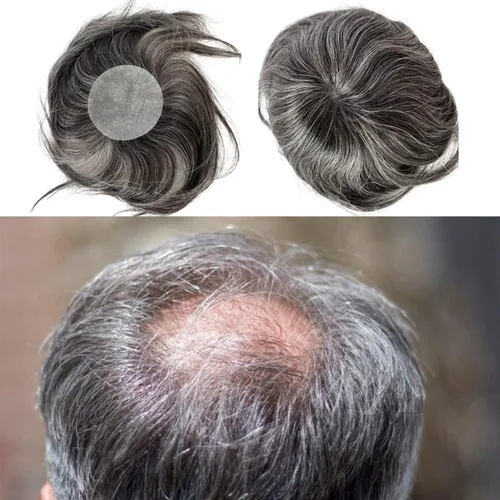 Miniatura 13 de Voloria Parche para el cabello calvo para hombres, 3.15 x 3.15 pulgadas, sistema de reemplazo de cobertura completa de piel de poliuretano