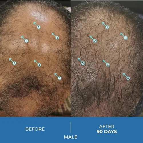 Miniatura 3 de DS Labs Spectral.UHP - Suero de densidad capilar al 5%, fórmula tópica extra fuerte para cabello de aspecto más grueso, se dirige al adelgazamiento