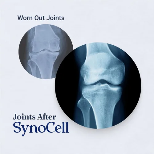 Miniatura 2 de Suplemento de apoyo para la espalda, el cuello y las articulaciones de glucosamina y condroitina de Synocell con boswellia, quercetina y MSM