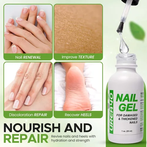 Miniatura 5 de Urea Nail Gel - Suaviza los callos agrietados del talón y las uñas gruesas de los pies - Repara uñas dañadas, amarillas y decoloradas - Tratamiento