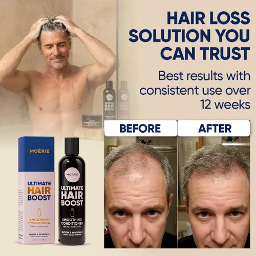 Miniatura 5 de Moerie Acondicionador para el crecimiento del cabello para hombres y mujeres, solución de pérdida de cabello con biotina y romero, acondicionador