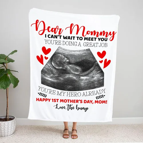 Miniatura 4 de Manta de fotos personalizada con ecografía para padres, manta de ultrasonido para primera vez, mamá y papá, imagen de ecograma personalizada única