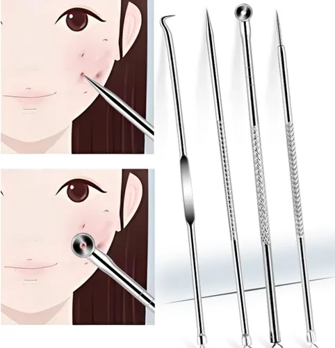 Miniatura 5 de Kit de pinzas para eliminar puntos negros, pinzas ultrafinas, extractor de manchas de puntos negros, aguja de acné, limpiador facial, herramienta