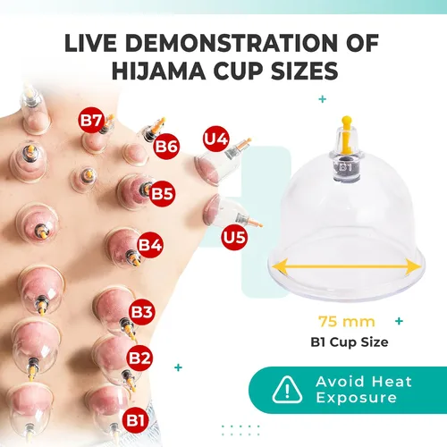 Miniatura 2 de [Paquete de 100 ventosas a granel para terapia de masaje – B1 B2 B3 B4 B5 B6 B7 U4 U5 – B1 (2.95 pulgadas) – Juego de terapia profesional al por