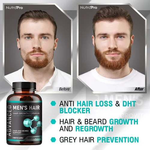Miniatura 5 de Vitaminas para el crecimiento del cabello para hombres + limpieza y desintoxicación pulmonar. Apoya la salud pulmonar. Apoya la salud respiratoria.