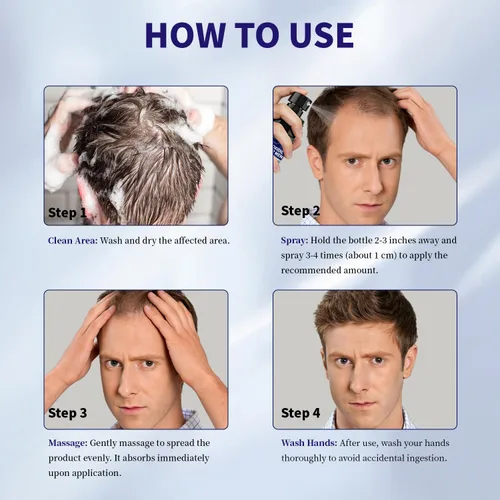 Miniatura 6 de Minoxidil para hombres y cabello Minoxidi con 5% de biotina de minoxidil y romero y para tratamientos de crecimiento de barba y cabello, solución