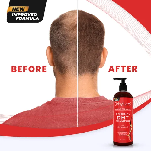 Miniatura 7 de DHT Blocker Champú y acondicionador - Para mujeres y hombres, fabricado en Estados Unidos, tratamiento contra la caída del cabello, con biotina