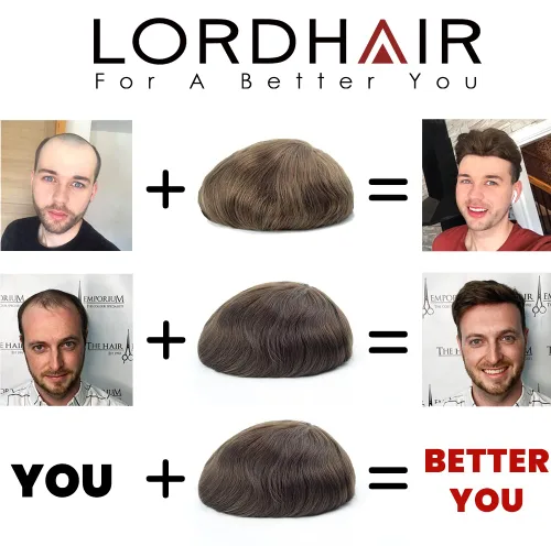 Miniatura 7 de Lordhair Sistema de cabello para hombres inyectado de piel fina cabello humano unido con encaje de diamante, 8 x 10 pulgadas, tamaño base, tupé #1A
