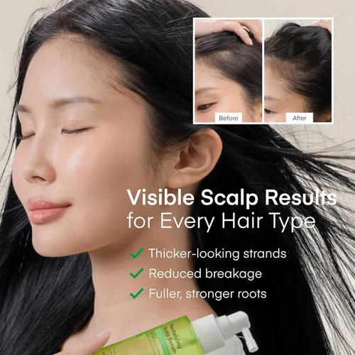 Miniatura 5 de Sérum para el cuero cabelludo en aerosol para el crecimiento del cabello - Tratamiento vegano coreano para la pérdida de cabello, adelgazamiento
