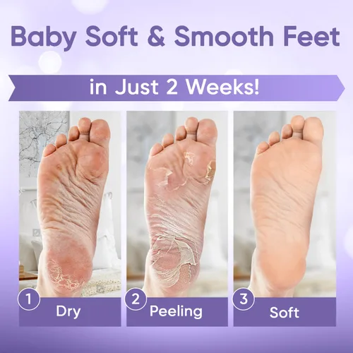 Miniatura 4 de Máscara exfoliante para pies - Máscara para pies con piel suave de bebé - Elimina la piel muerta, seca, agrietada y callos, spa para pies, hecha