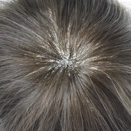 Miniatura 15 de Sistema de repuesto de cabello humano europeo con encaje frontal suizo para hombre, tupé para hombre, pieza de cabello, nudo blanqueado, línea #17