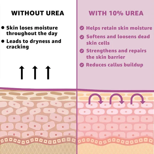 Miniatura 8 de Crema 10% de urea con aloe vera, aceite de jojoba y ácido salicílico, 5.1 fl oz hidratante para manos, pies, cara y cuerpo secas y agrietadas