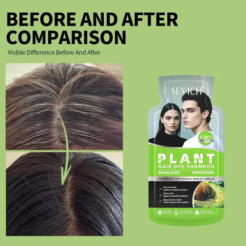 Miniatura 3 de SEVICH Champú de tinte para el cabello de ginseng 5 en 1 para mujeres y hombres Tratamiento de depósito de color 10 sobres de un solo uso