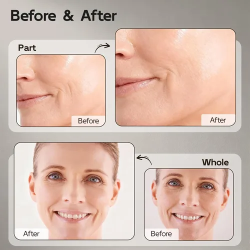 Miniatura 6 de Suero de retinol para cara y cuello, antienvejecimiento B5 suero facial rejuvenecedor con niacinamida + colágeno + ácido hialurónico, suaviza