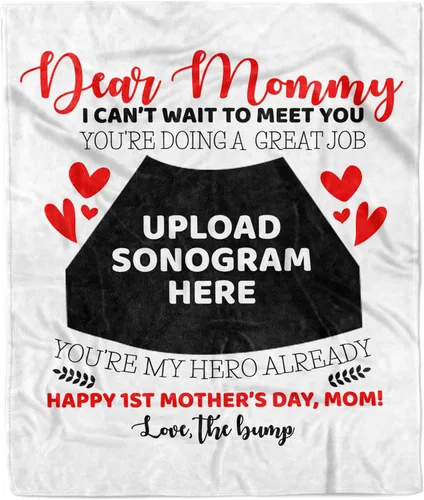 Manta de fotos personalizada con ecografía para padres, manta de ultrasonido para primera vez, mamá y papá, imagen de ecograma personalizada única