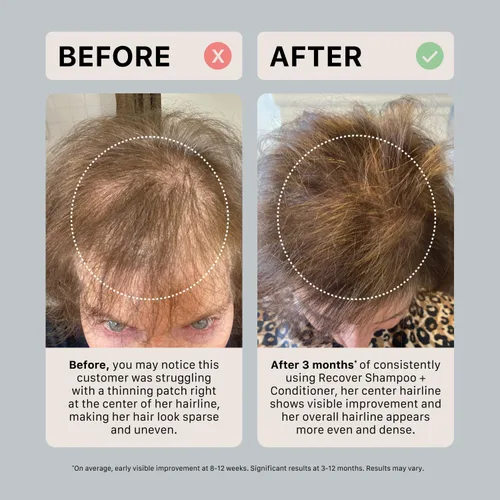 Miniatura 6 de ACTIIV Recover Travel Duo para mujer Apoya la apariencia de un cabello más completo y saludable, a base de plantas, seguro para el color, vegano