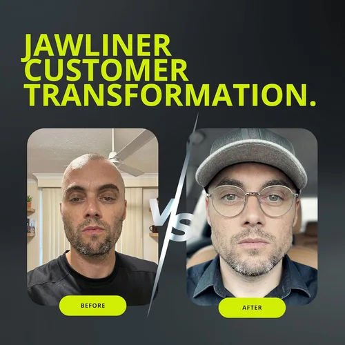 Miniatura 9 de Jawliner® - Pioneros de la goma de mandíbula artesanal más resistente 15 veces más dura, incluye 12 semanas de entrenamiento - Goma dura de menta