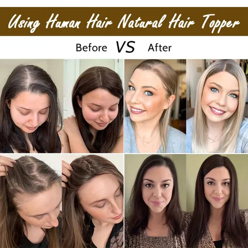 Miniatura 6 de forfeels Toppers de pelo sintético para mujer, fibra de proteína, 20 pulgadas, piezas de cabello para mujer, color marrón, resuelven mujeres
