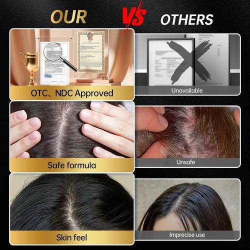 Miniatura 8 de Solución tópica de minoxidil USP 5% para hombres y mujeres - Tratamiento de crecimiento capilar OTC, fármaco monográfico de la FDA, fórmula no grasa