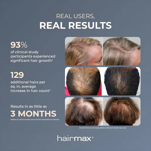 Miniatura 11 de Hairmax LaserBand 82 - Tratamiento para el Crecimiento y Rebrotes del Cabello - Restaura el Ciclo Natural del Cabello - Dispositivo Médico de Uso
