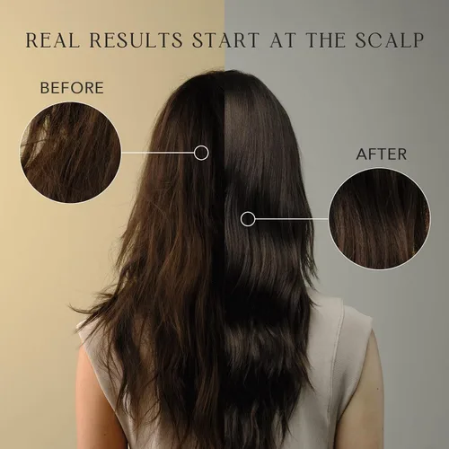 Miniatura 5 de KIWABI ROOT BEAUTÉ - Acondicionador para el cuero cabelludo – Tratamiento para el crecimiento del cabello y el cuero cabelludo para adelgazamiento