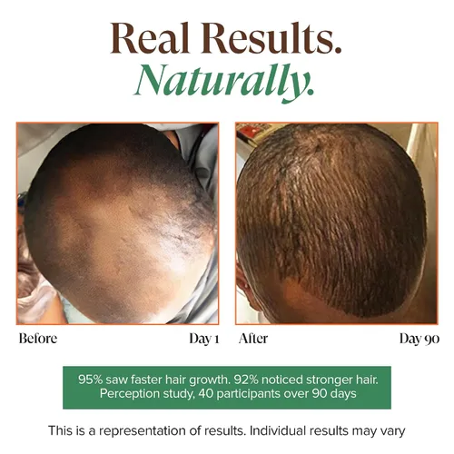 Miniatura 6 de Kreyol Essence - Aceite de ricino negro haitiano para piel y cabello, botella de vidrio, prensado en frío, sin hexano, cabello de aspecto más