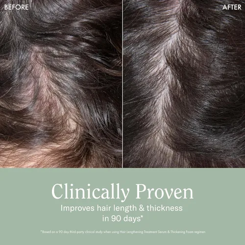 Miniatura 4 de Rizos Curls Tratamiento 2 en 1 de espuma espesante + moldeador, mejora el grosor del cabello, reduce la rotura, aumenta el volumen en las raíces