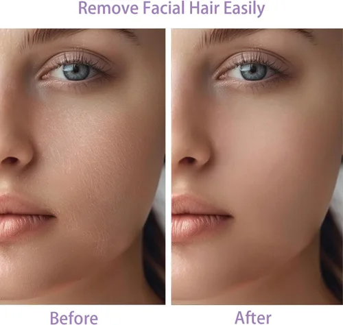Miniatura 3 de Dispositivo de Eliminación de Vello Facial para Mujeres, Operado con Batería y con 2 Cabezales de Repuesto, Afeitadora Facial Indolora para Mujeres