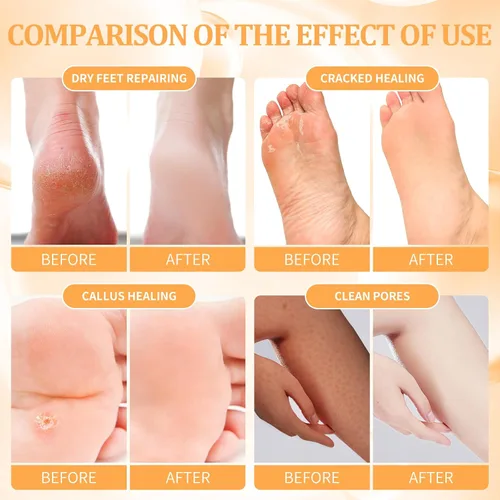 Miniatura 3 de Juego de spa de pedicura para pies, kit de pedicura para el hogar con sal de baño, loción hidratante de crema exfoliante para pies, cuidado de pies