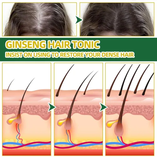 Miniatura 3 de Spray para el crecimiento del cabello, tonico para crecimiento del cabello, hierbas naturales, tónico para el cabello ginseng, más fuerte y 1