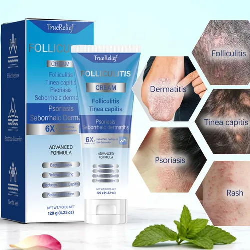 Miniatura 9 de Crema de foliculitis Alivia y ayuda a eliminar protuberancias en el cuero cabelludo, la cara, el cuerpo y los glúteos para pelos encarnados
