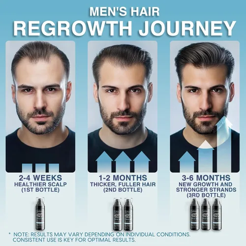 Miniatura 5 de Suero natural para el crecimiento del cabello para hombres: aceite para el cabello y el cuero cabelludo con romero, aceite de batana, agua de arroz