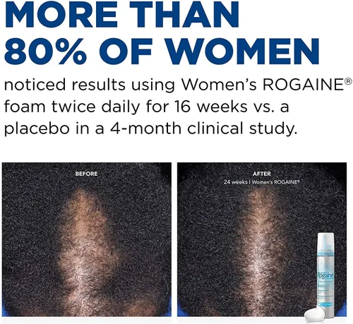 Miniatura 5 de Rogaine - Espuma de minoxidil tópica al 5%, tratamiento contra la caída del cabello de una vez al día para mujeres para hacer crecer un cabello más