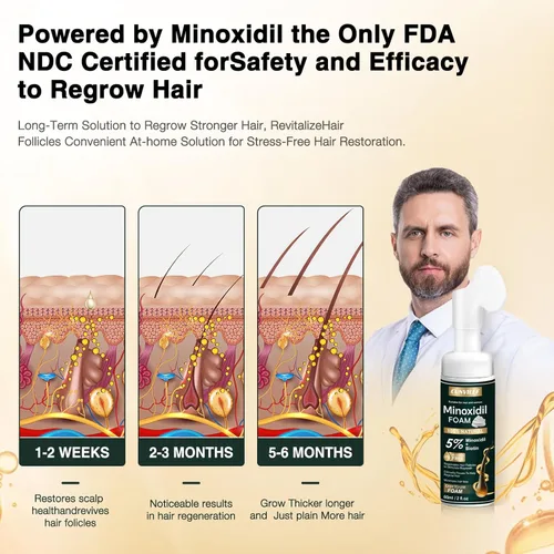 Miniatura 4 de 5% de espuma de minoxidil para hombres y mujeres, ralentiza la pérdida de cabello y promueve el tratamiento de crecimiento del cabello para mujeres