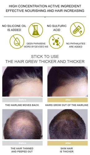 Miniatura 6 de Aceite de jengibre para el crecimiento del cabello, suero de biotina para el crecimiento del cabello, aceite esencial de jengibre natural 100% puro