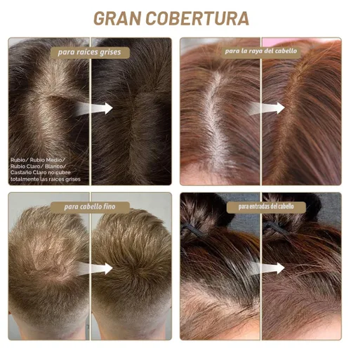Miniatura 4 de SOVONCARE Polvo para la Línea del Cabello – Retoque de Raíces y Corrector de Canas para Hombres y Mujeres, Cubre Instantáneamente el Cabello Ralo