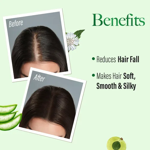 Miniatura 4 de KESH KING Champú anti caída de cabello con hierbas ayurvédicas y aloe vera proporciona cuero cabelludo nutrido saludable para un cabello suave