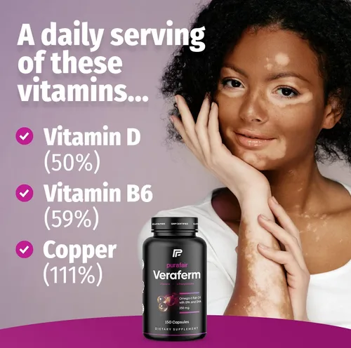 Miniatura 5 de ¿Vitiligo? Mejora la pigmentación de la piel y deshazte de las manchas blancas en la piel con este tratamiento de vitíligo: Veraferm. Estas píldoras