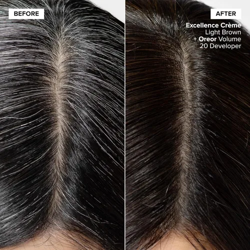 Miniatura 2 de L'Oréal Technique Excellence Crème Permanent Hair Color Long-Lasting Hair Dye Rich Formula with No-Drip Application Superb Gray Coverage For