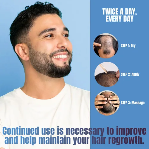 Miniatura 5 de Suero tópico para el crecimiento del cabello de minoxidil al 5% para hombres y mujeres, suero para el crecimiento del cabello para la pérdida
