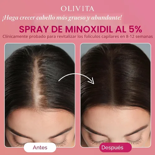 Miniatura 4 de Spray de minoxidil al 5% para el crecimiento del cabello de las mujeres: tratamiento de recrecimiento capilar extra fuerte, revitaliza los folículos