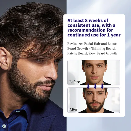 Miniatura 4 de Minoxidil para hombres y cabello Minoxidi con 5% de biotina de minoxidil y romero y para tratamientos de crecimiento de barba y cabello, solución
