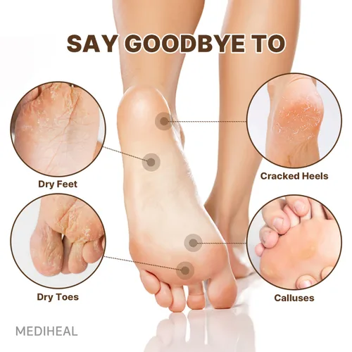 Miniatura 4 de MEDIHEAL Derma Layer - Máscara para pies (5 unidades) para pies y dedos secos, talones agrietados, callos cuidado de la humedad con ceramidas