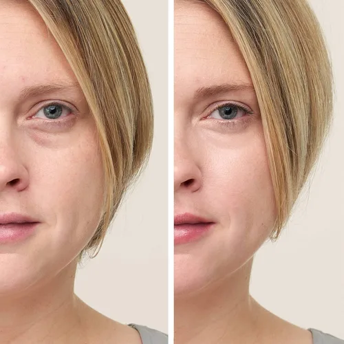 Miniatura 4 de jane iredale CircleDelete Corrector Corrector cremoso para debajo de los ojos con vitaminas A, C y E Disminuye la apariencia de las ojeras y NO.